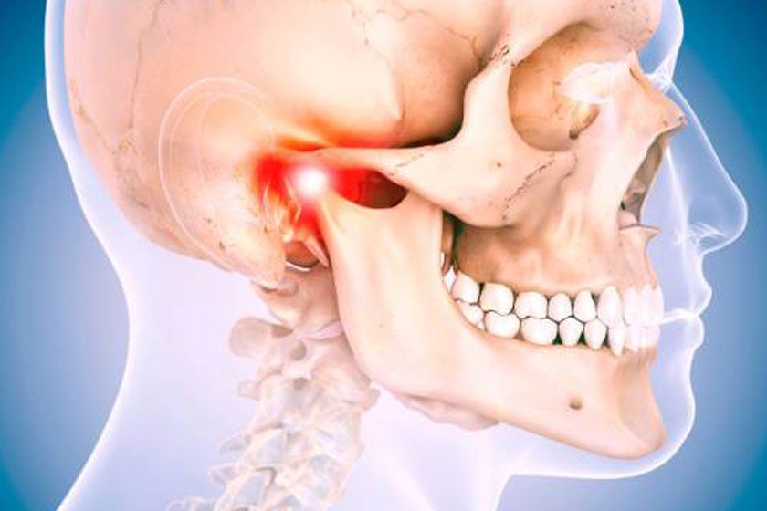 Symptoms of Temporomandibular Joint Disorders