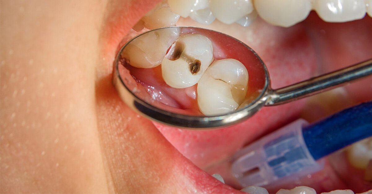 How Long do Dental Treatments Take?