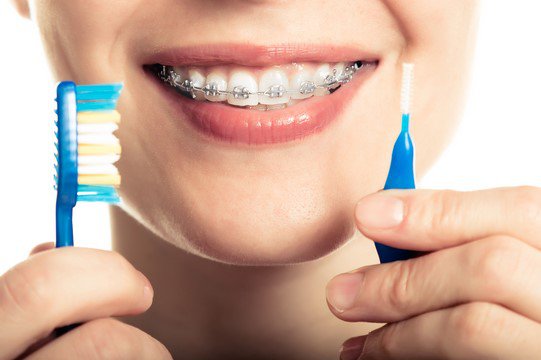 How to Use Dental Floss with Braces?
