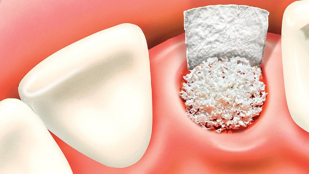 What is Bone Powder?