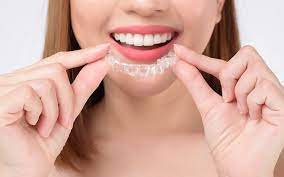Clear Aligner Orthodontic