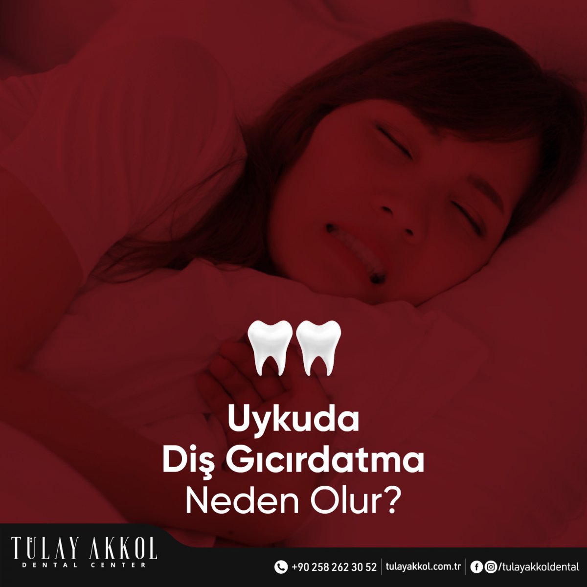 What Causes Teeth Grinding During Sleep?