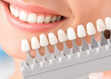 Yaprak Porselen Nedir?