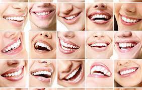 Tooth Models According to Face Shape